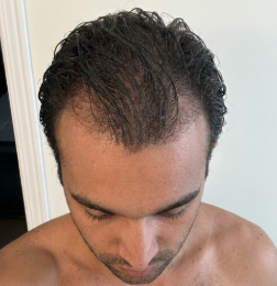 "subtle but it’s definitely there"
