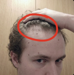 "Didn’t expect this to actually work"